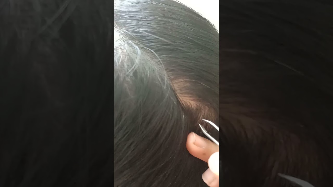 Nhổ tóc bạc cho mẹ 