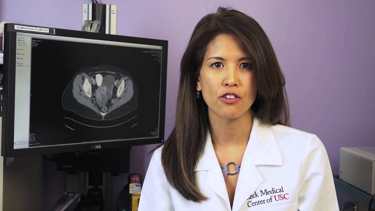 Survival Rates &ndash; Ovarian Cancer Answers