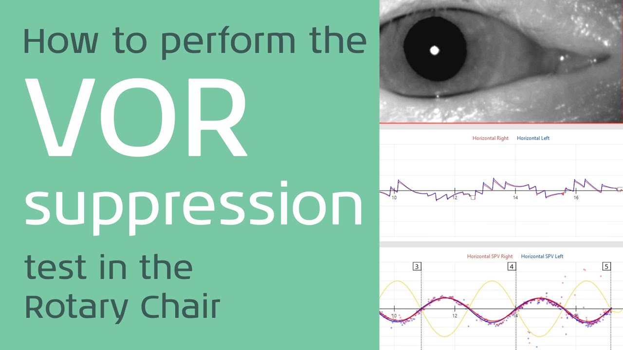 How to perform the VOR Suppression Test on the Rotary Chair