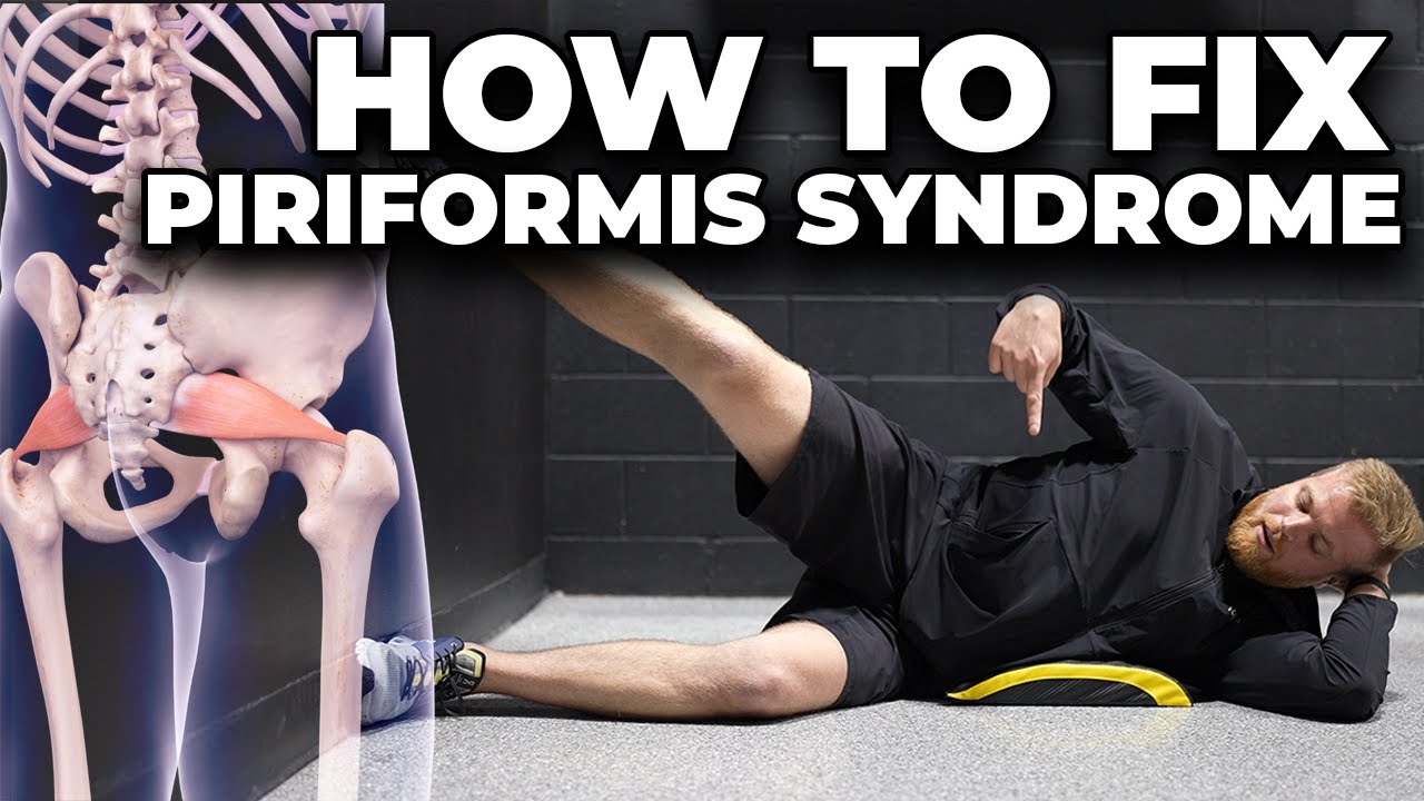 How To Fix Piriformis Syndrome