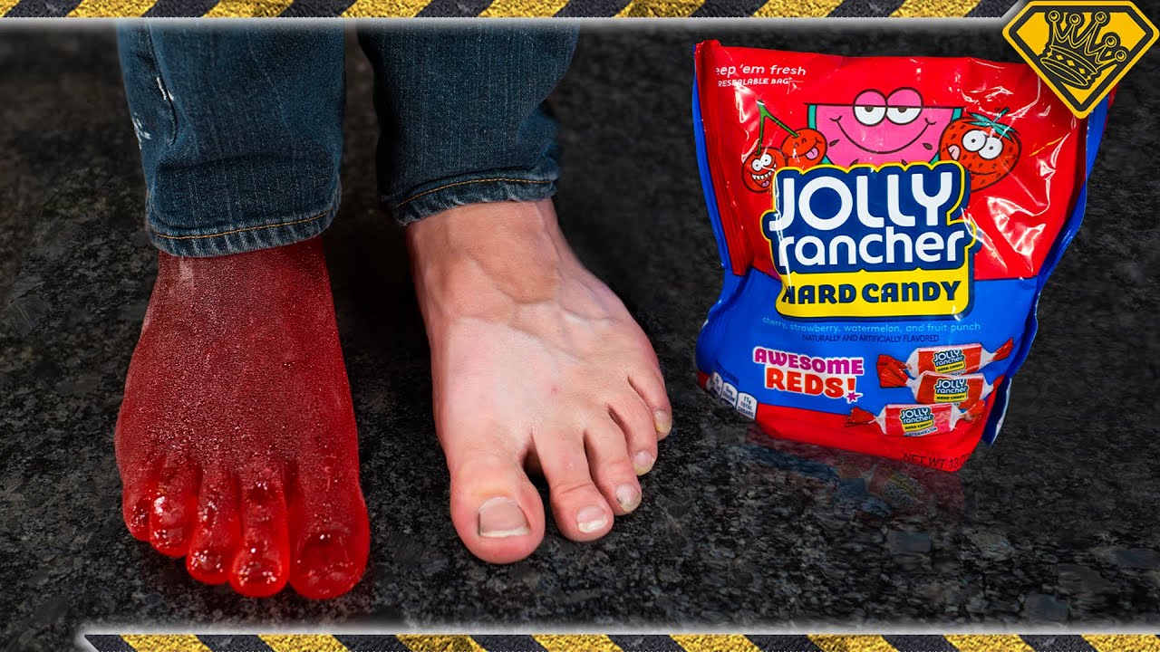 Turning My Foot Into a Jolly Rancher