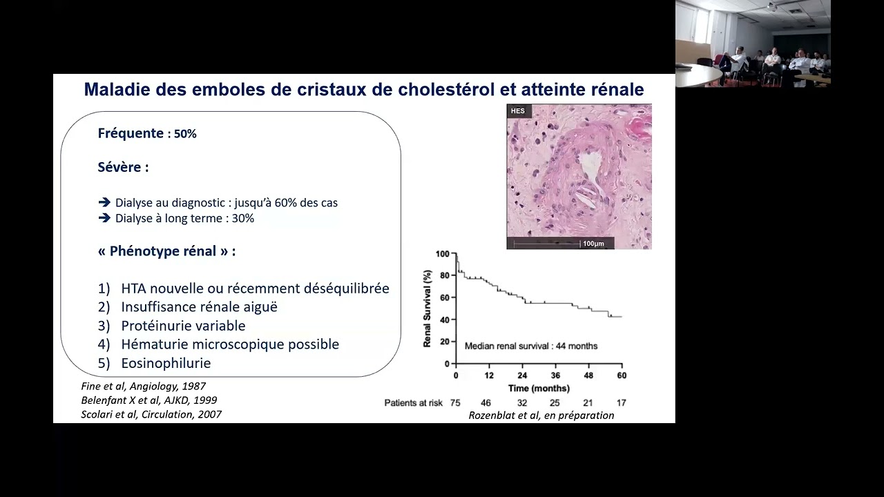 Embols de cholestérol