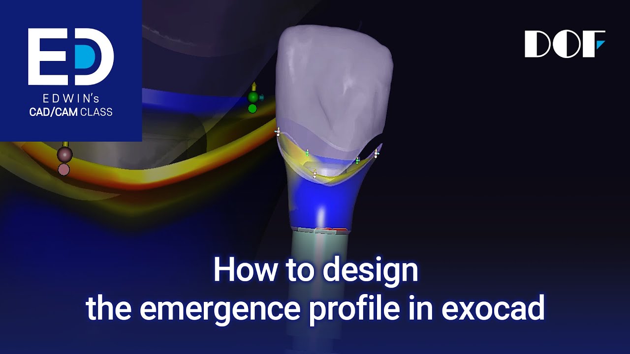 How to design the emergence profile in exocad