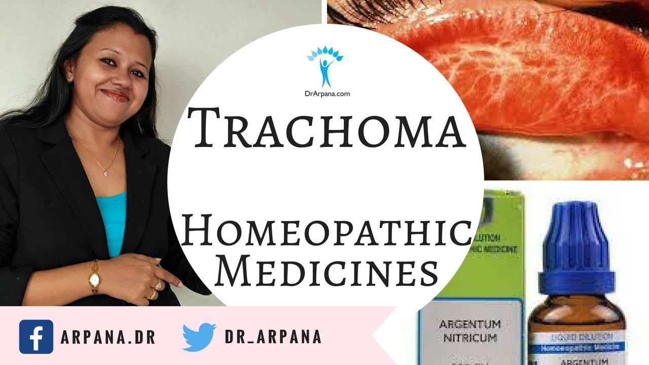 ट्रेकोमा के लक्षण कारन व होम्योपैथिक दवाई || TRACHOMA Causes Homeopathic Medicines