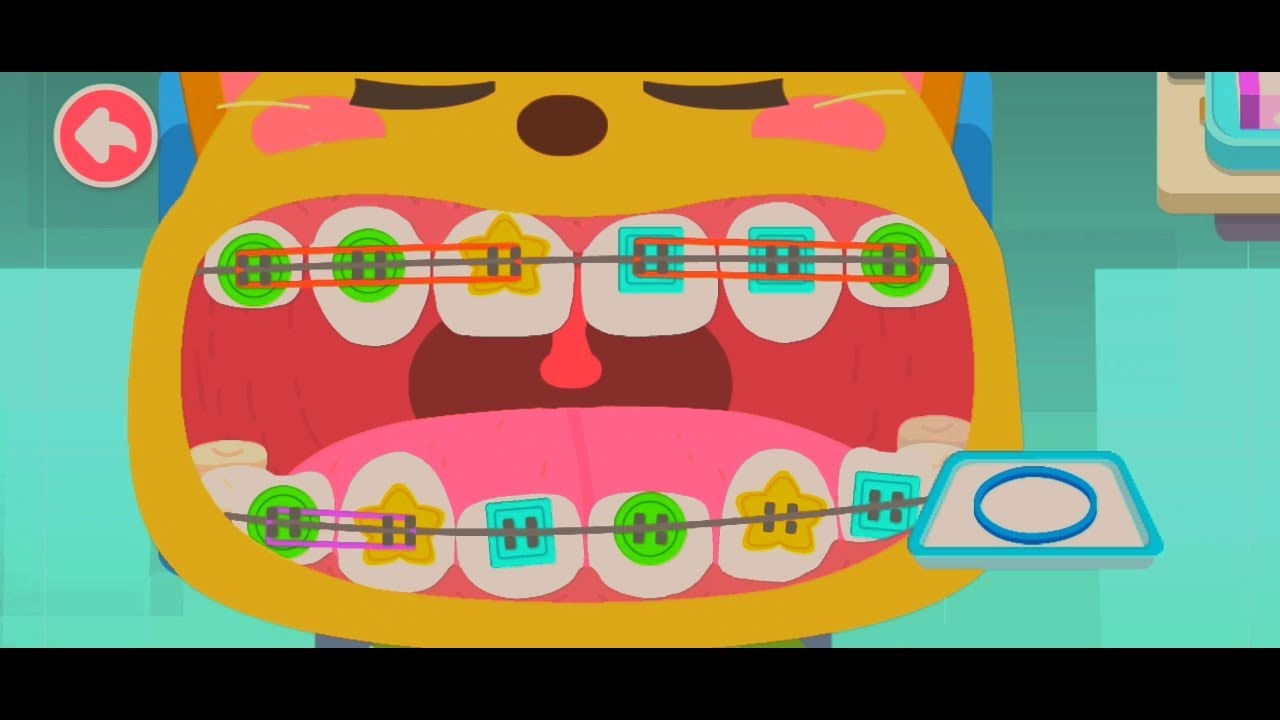 Seru! Main Dokter Gigi 🦷 Pasang Behel Warna-Warni yang Lucu