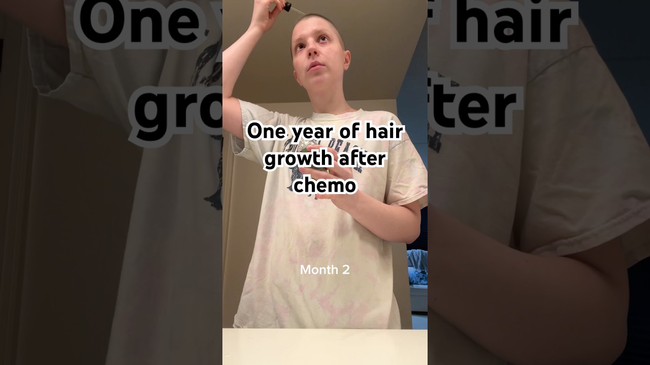 One Year of Hair Growth Post Chemo