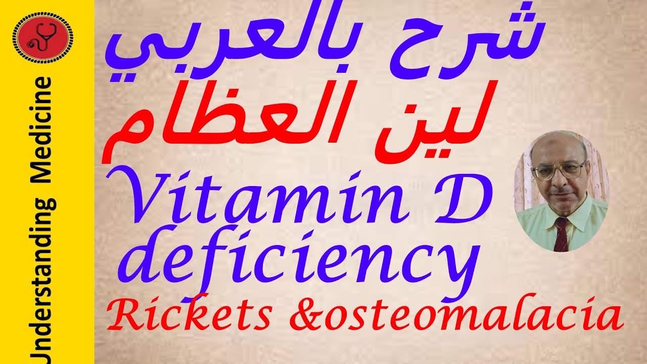 Vitamin D , deficiency ,Rickets and  Osteomalacia شرح بالعربي  نقص فيتامين د ولين العظام