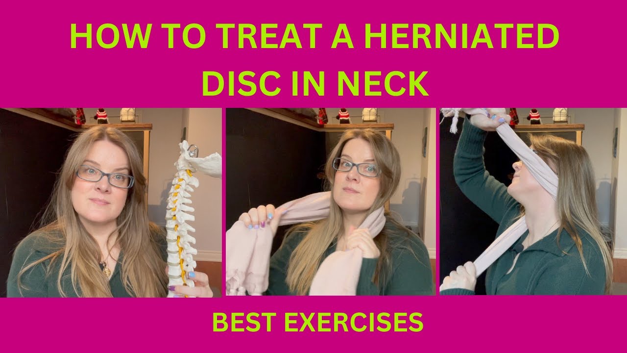 How to treat a herniated disc in neck | Dr. Kristina Turkewitsch Chiropractor in Newmarket
