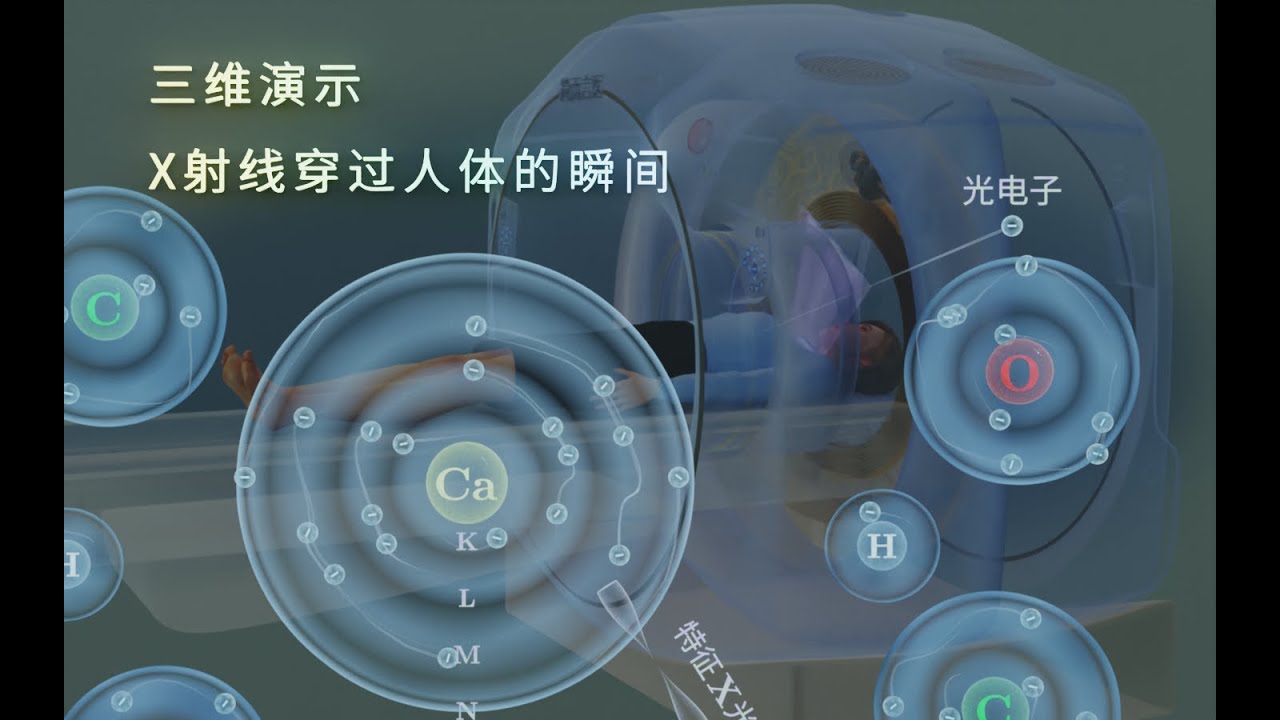 X光片、CT扫描、透视的成像机制及致癌风险