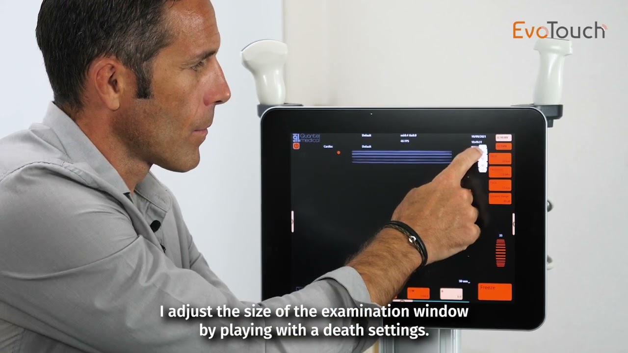 EvoTouch - EvoTouch+: High definition imaging under any circumstances - Video Tutorial