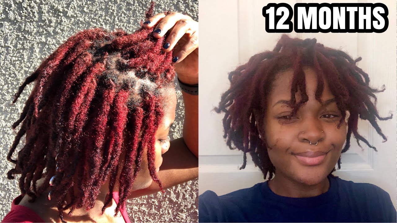 1 Year (12 Month) Loc Update with Pictures and Videos + Mental Health Update/ Where I've Been| Coils