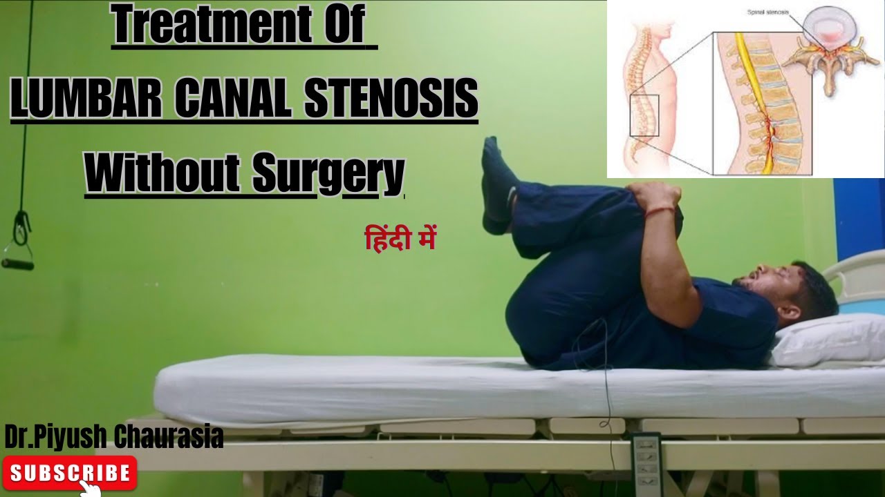 Effective Flexion Exercises For Lumbar Canal Stenosis Treatment In Hindi
