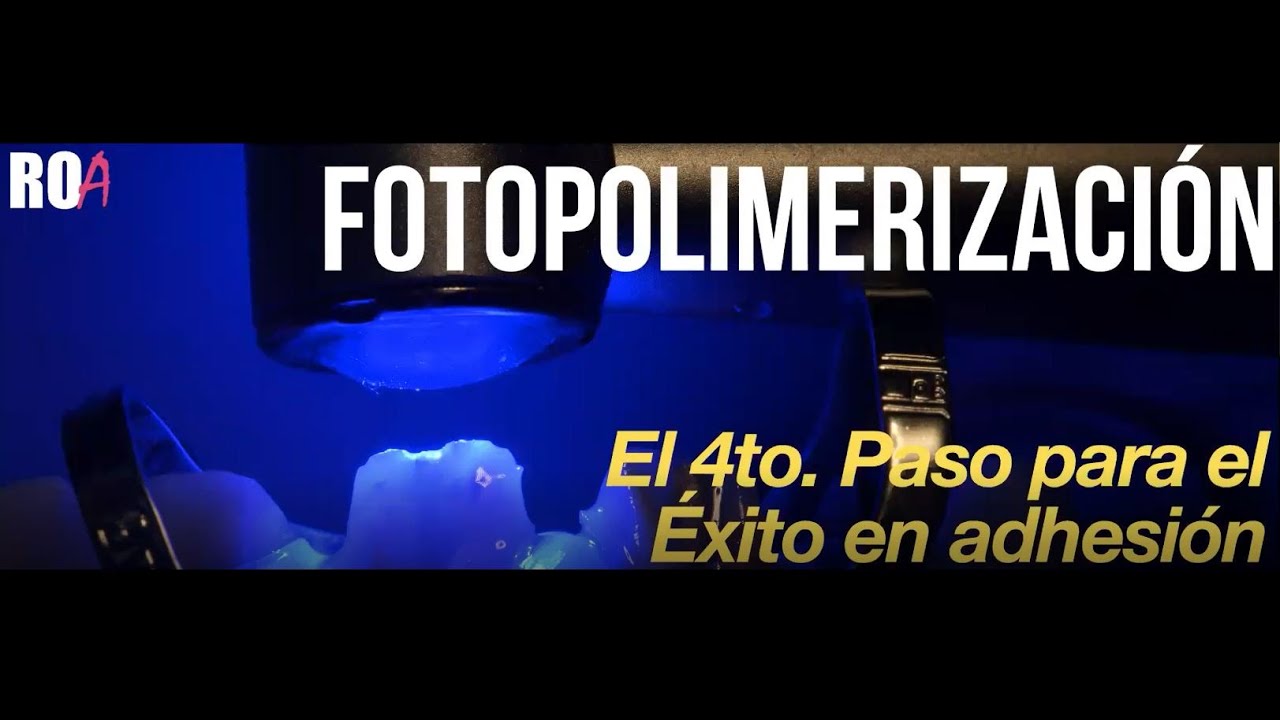 Fotopolimerización:  El 4to. paso para el éxito en la adhesión