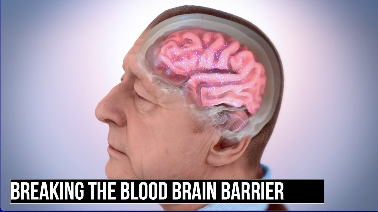 Breaking the Blood Brain Barrier:  A Breakthrough For Alzheimer's Research?