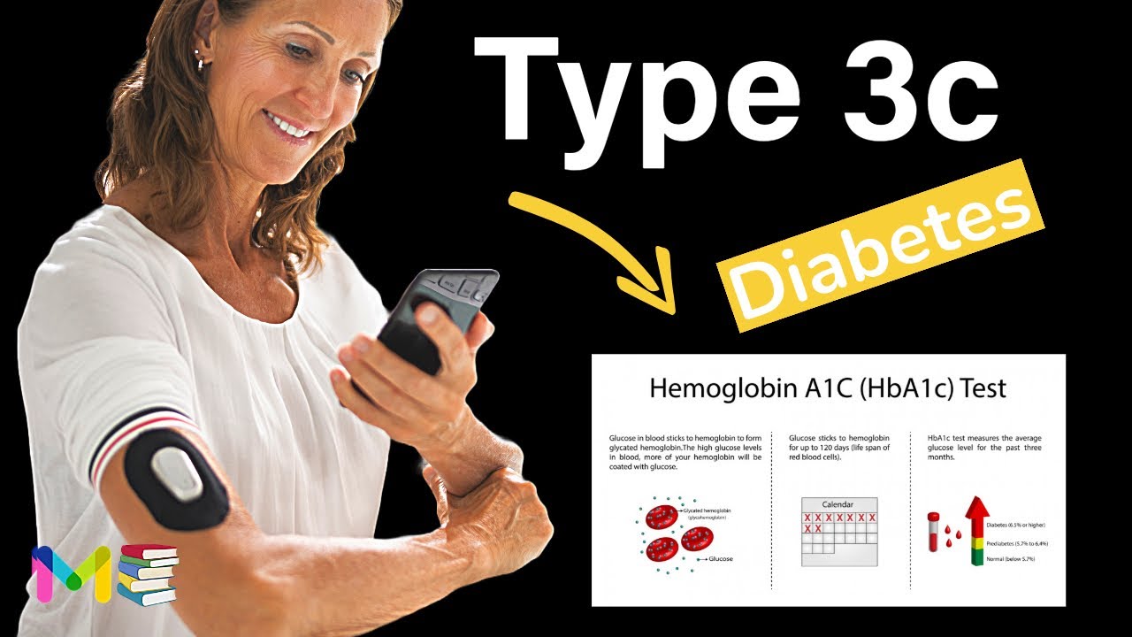 TYPE 3C DIABETES & Other Forms Of Diabetes Mellitus