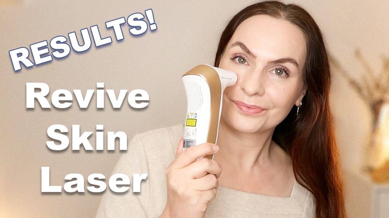 3 Month Update | DermRays Revive Laser My Honest Results