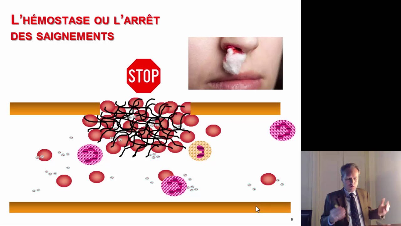 Cédric Hermans: L'hémophilie, 150 ans d'histoire