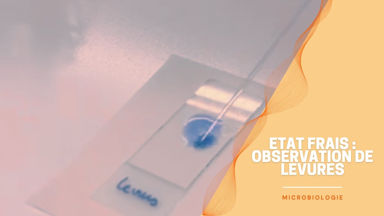 Microbiologie : Etat frais - observation de levures Saccharomyces