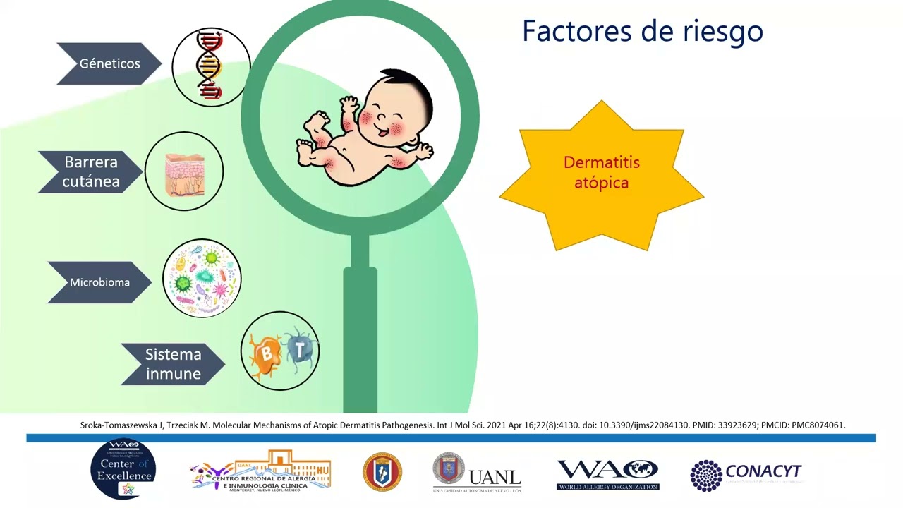Dermatitis atópica. Desencadentantes, imitadores y tratamientos
