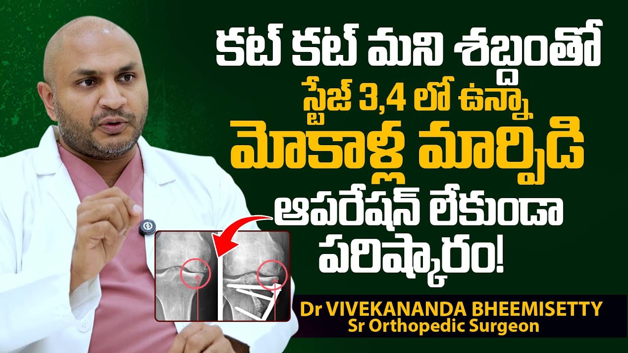 మోకాళ్ల మార్పిడి ఆపరేషన్ లేకుండా పరిష్కారం | Dr Vivekananda Bheemisetty About Knee Replacement Delay