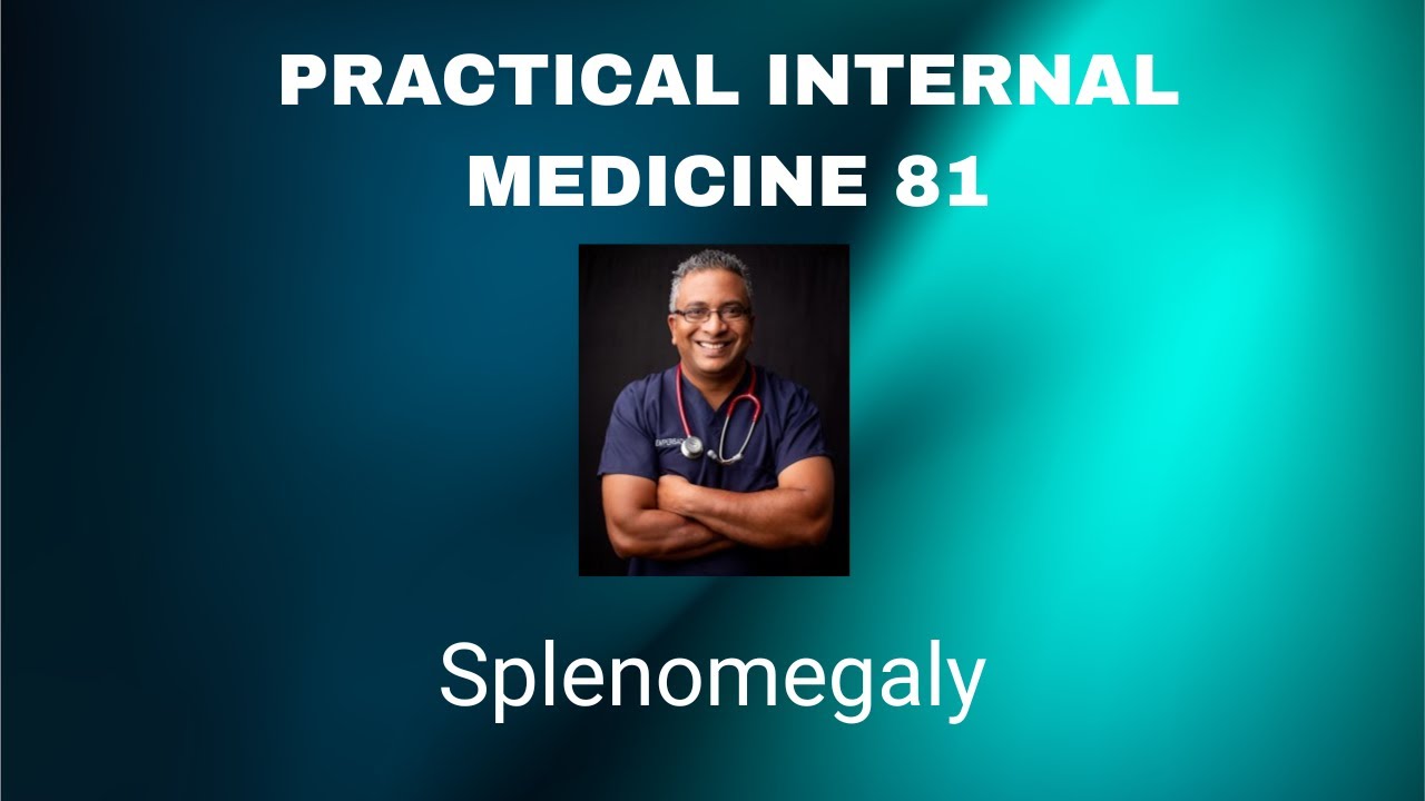 Practical Internal Medicine 81 : Splenomegaly