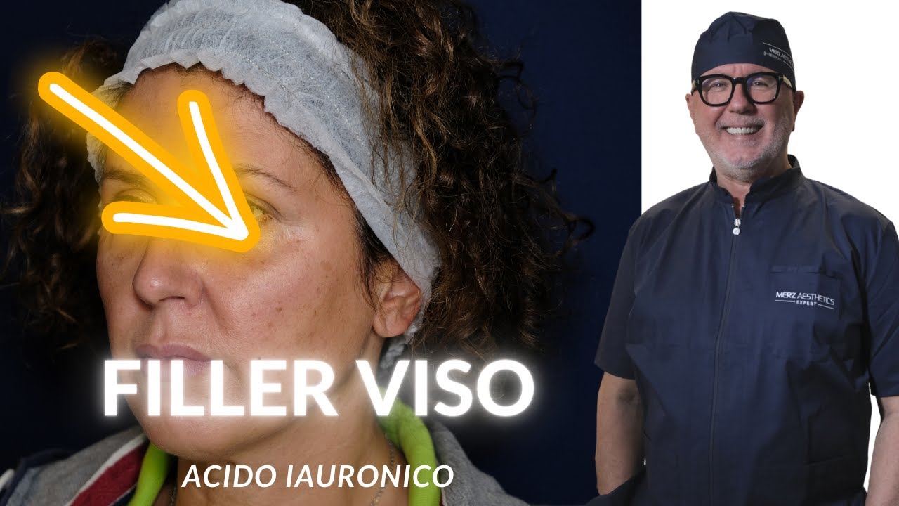 FILLER ACIDO IALURONICO VISO: Dott. Piercarlo Masolini