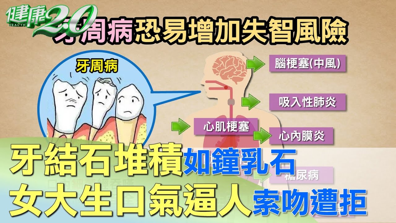 牙結石堆積如鐘乳石 女大生口氣逼人索吻遭拒 健康2.0