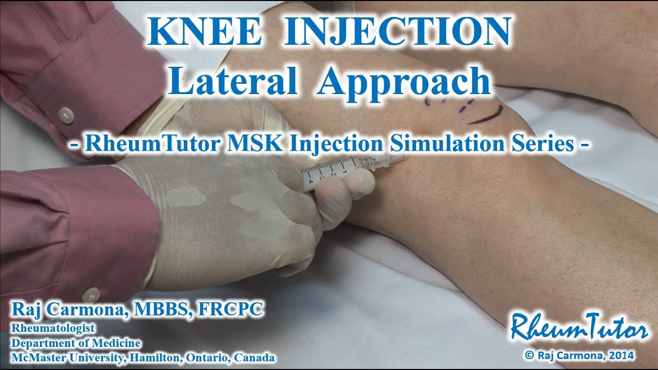 KNEE ASPIRATION / INJECTION - LATERAL APPROACH: Step-By-Step Teaching Simulation