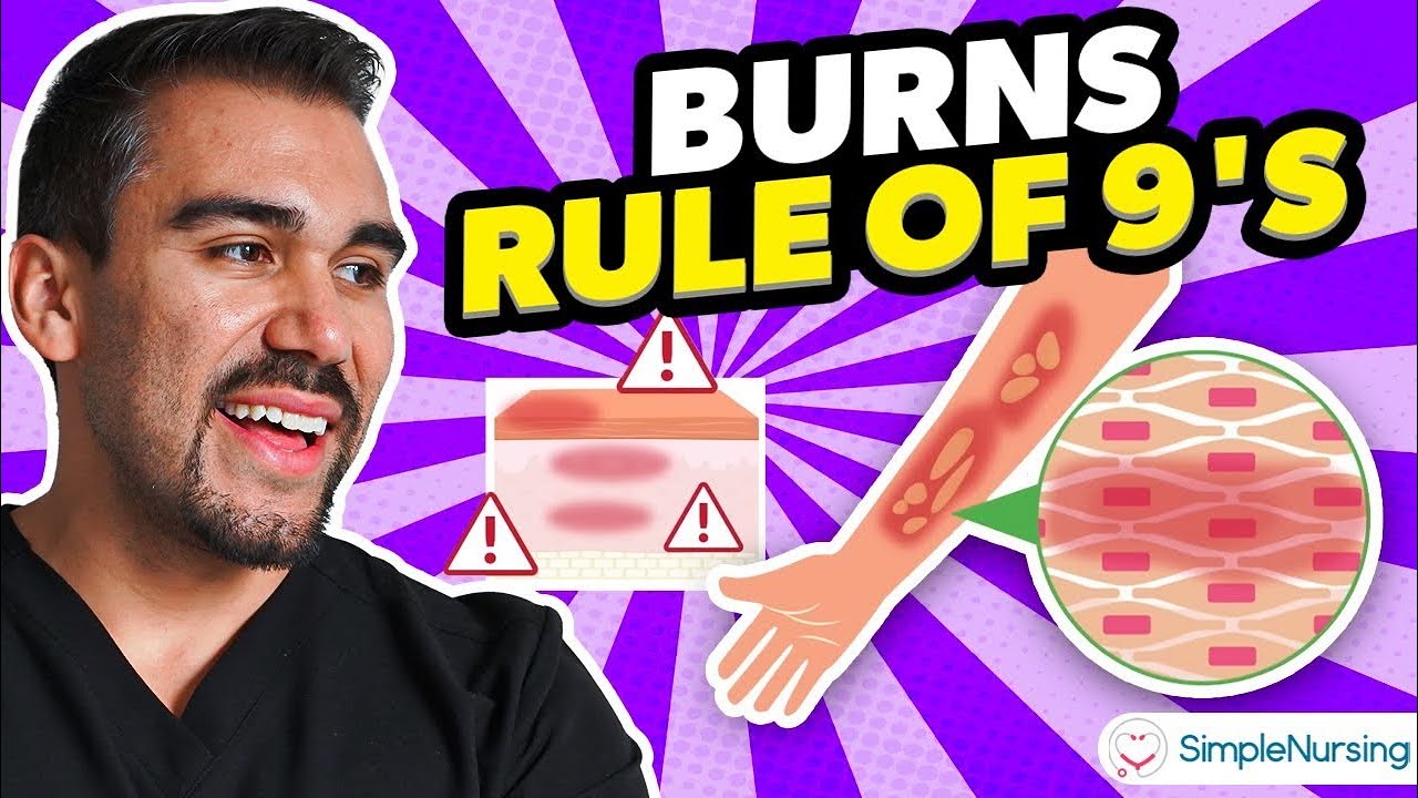 Burns Nursing Overview | Rule of Nines, Types, Causes, Care
