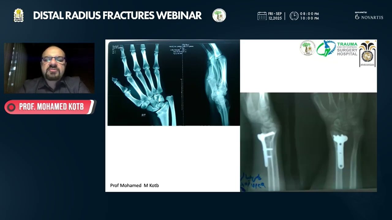 Distal Radius fracture decision making prof Mohamed Mostafa Kotp