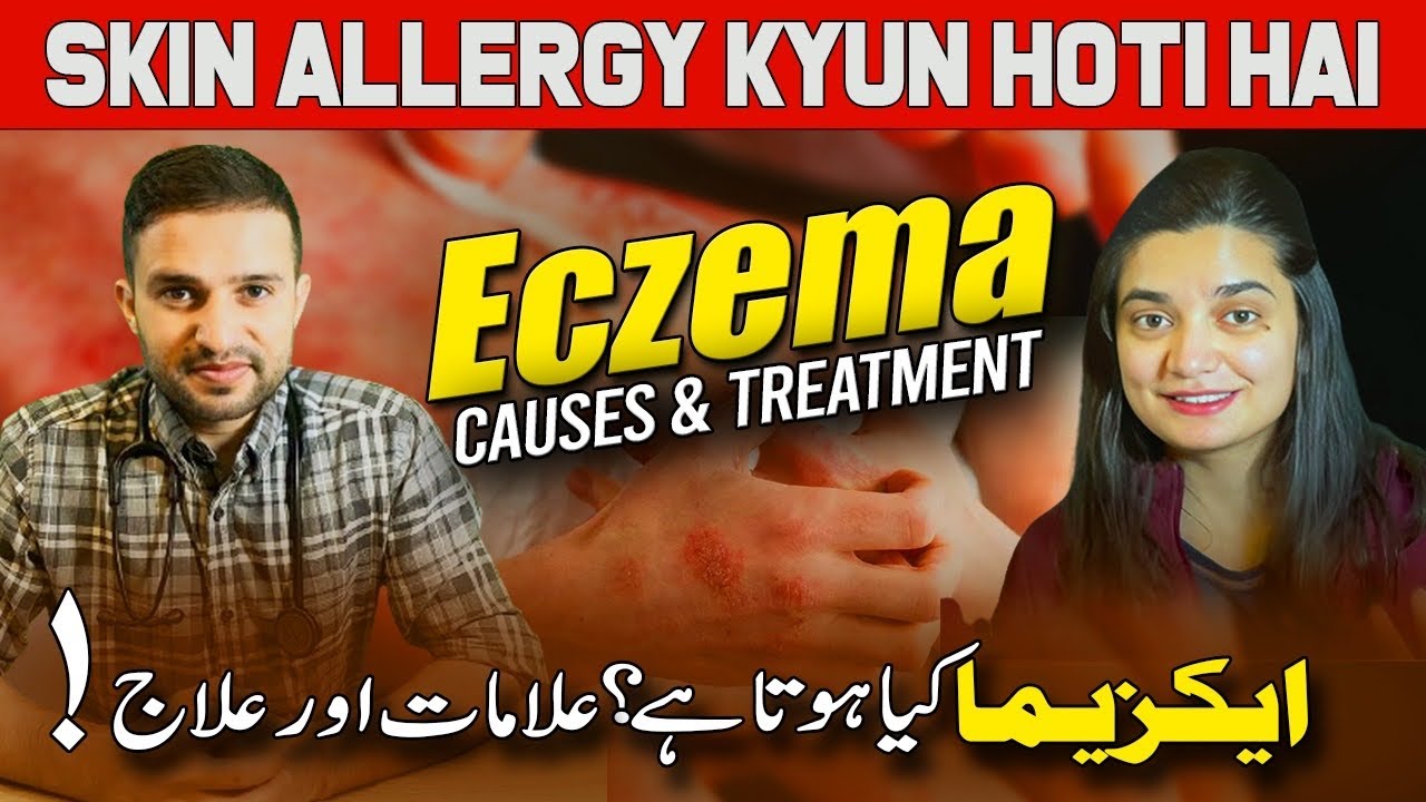 Eczema kya hota hai | Skin Allergy Kyun Hoti Hai | Eczema ka ilaj