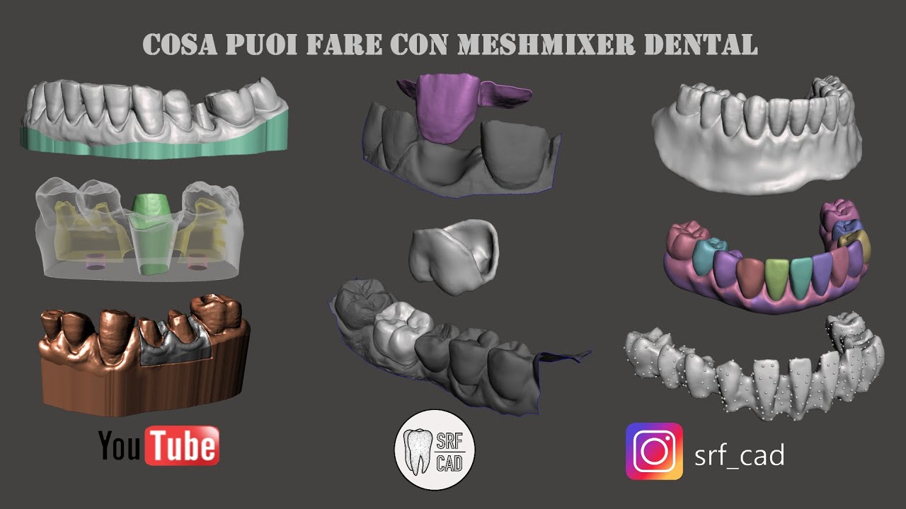MESHMIXER DENTAL : Cosa puoi fare con Meshmixer  MODELLI FISSA MOBILE TORONTO GELLER TWEED TUTORIAL