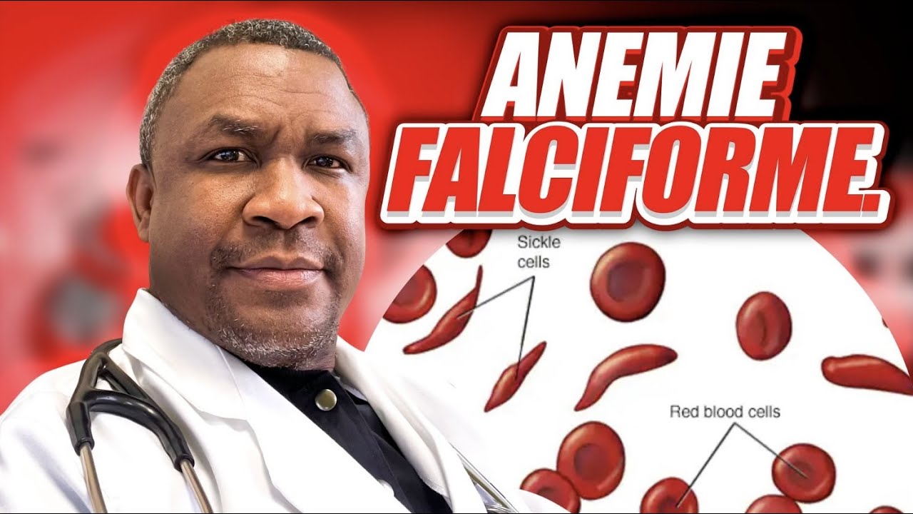 Anemie Falciforme: Bagay ou dwe konnen.