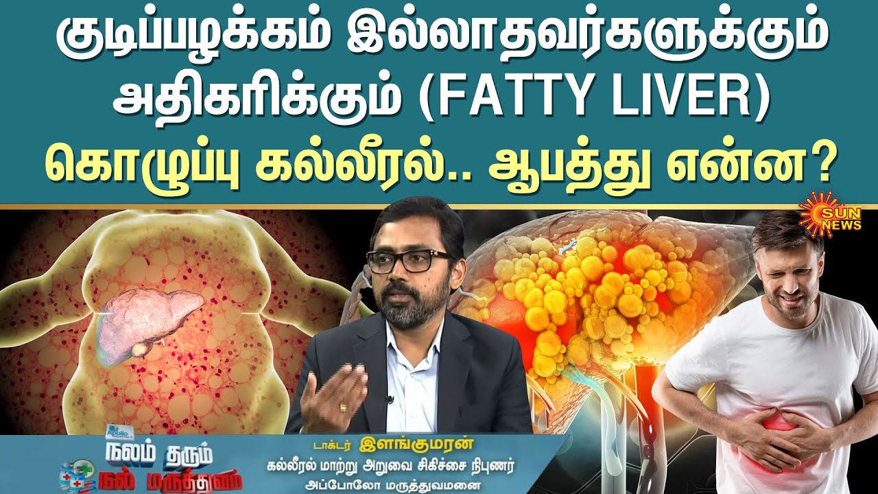 Fatty Liver | Non Drinkers | Dr. Elankumaran K | Gastroenterology | Urologist | Sun News
