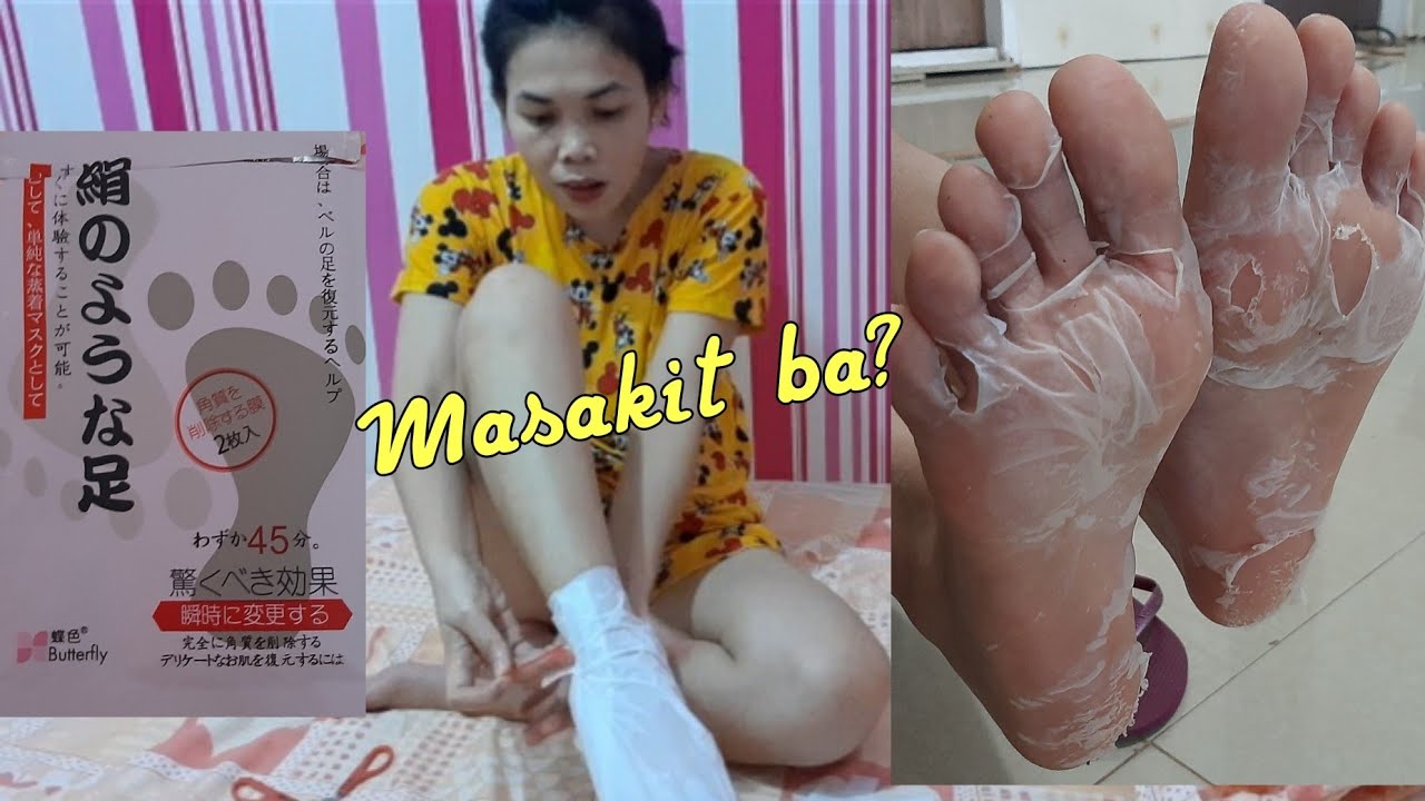 Paano tanggalin ang kalyo? || Quarantine Self Care - Japan Foot Mask