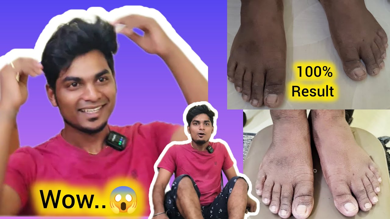 Wow...😮இனிமேல் Pedicure பண்றது இவ்ளோ Easy-ஆ 😍😍At home 