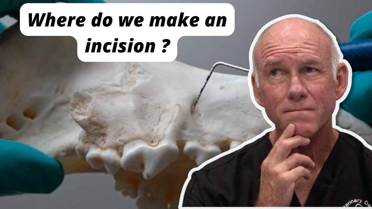 Where do we make an incision ?