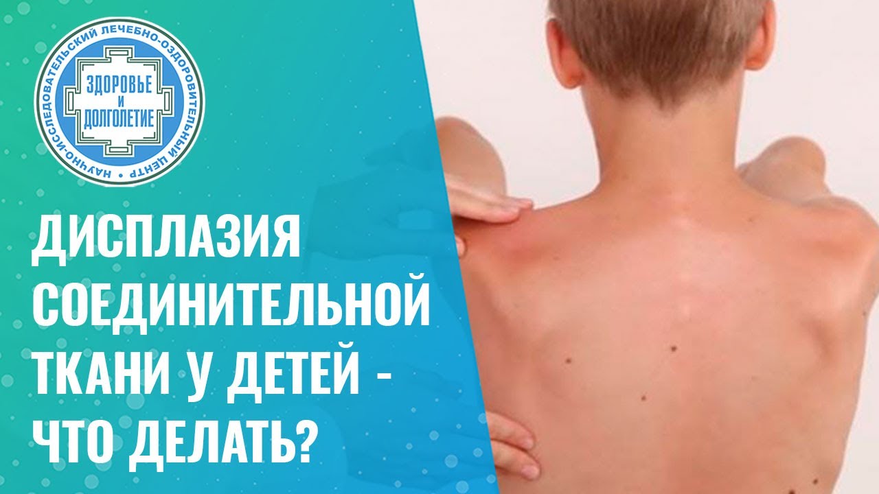 🤷‍♀️  Дисплазия соединительной ткани у детей - что делать?