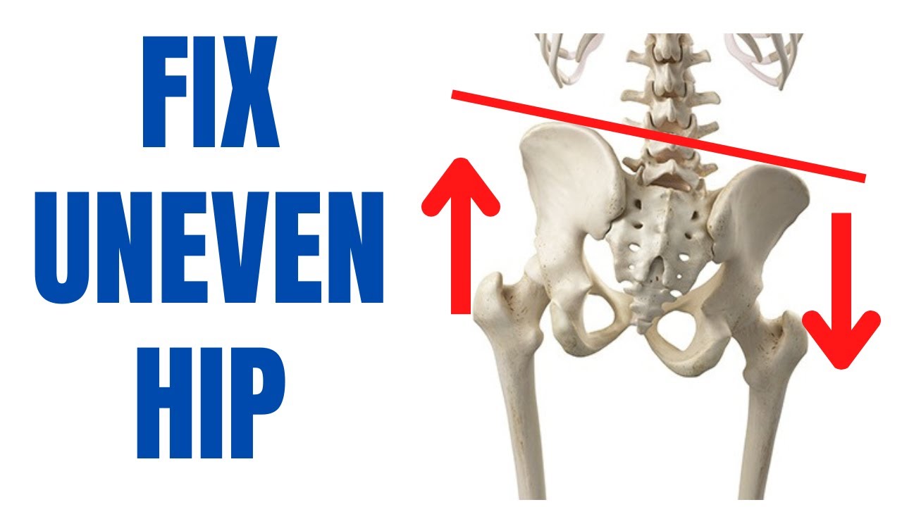 Fix Uneven Hip | Best Exercises For Hip Imbalance Correction | Pelvis Balancing Exercises
