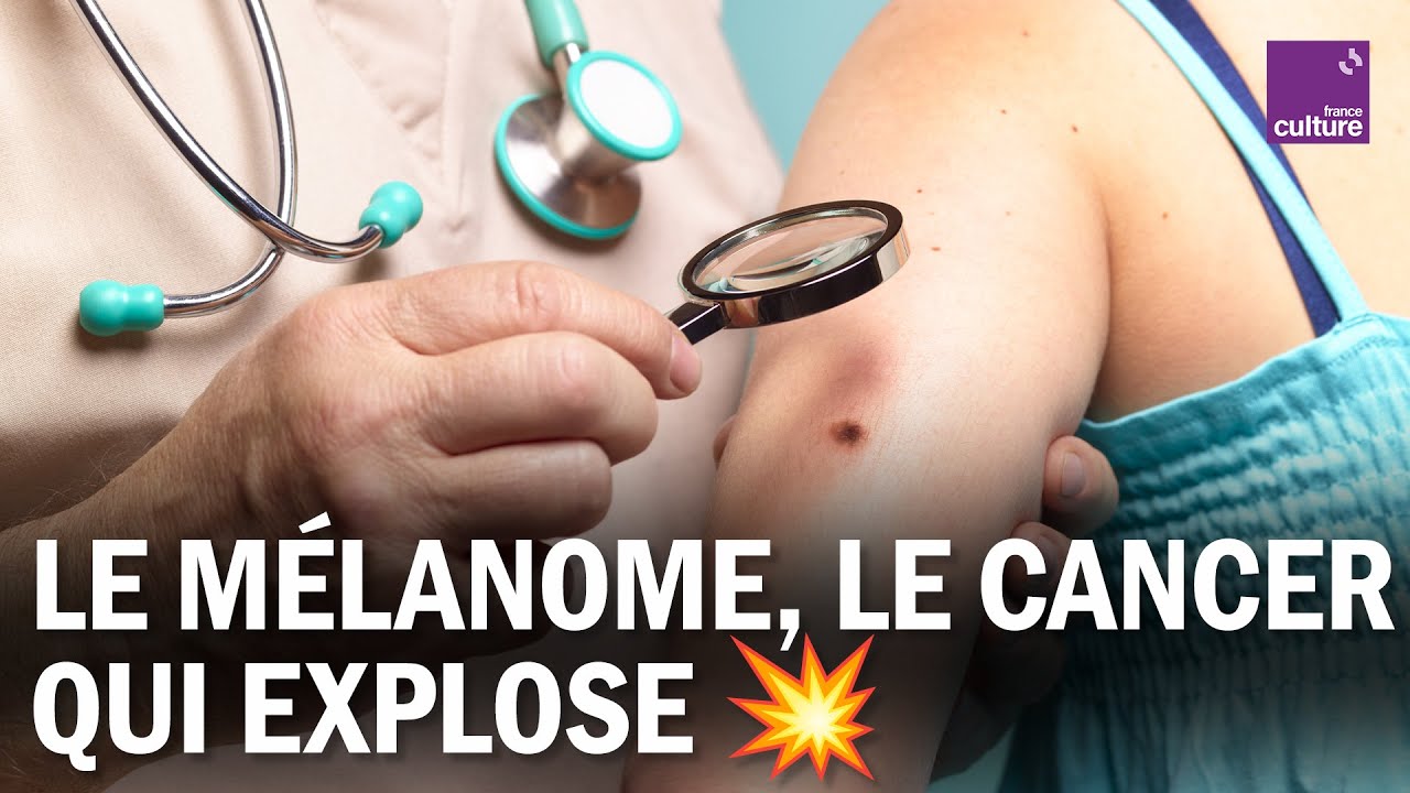Mélanome : les nouveaux espoirs contre UN CANCER AGRESSIF