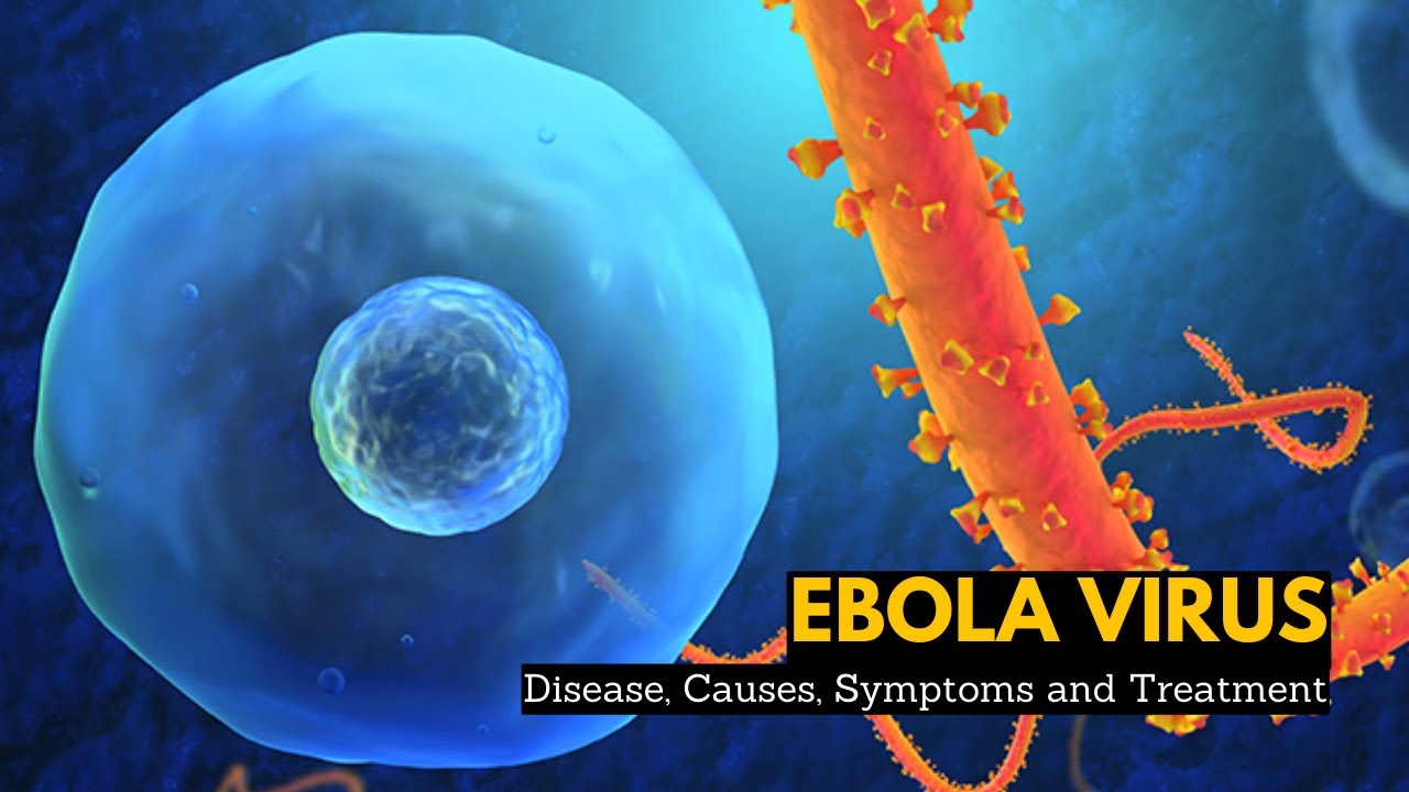 Ebola Virus Disease, Causes, Signs and Symptoms, Diagnosis and Treatment.