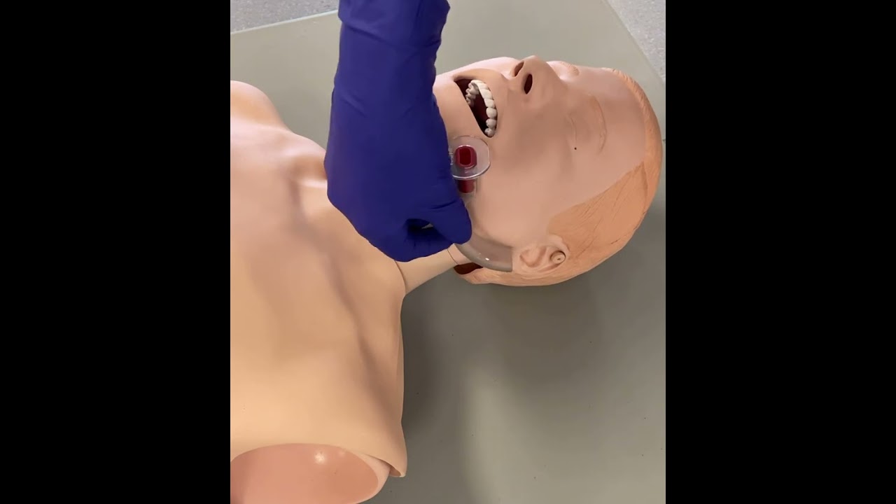 MHE Inserting an Oral Airway (OPA)