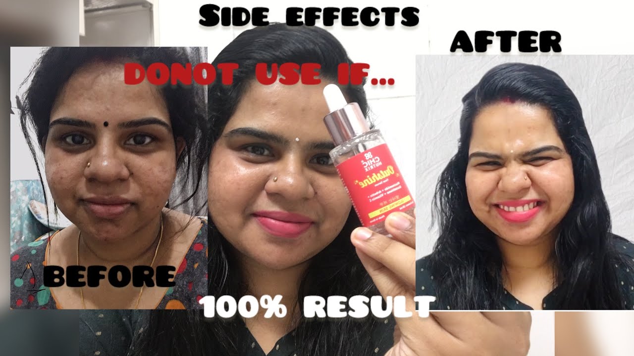 ഒരു GLASS SKIN കഥ😳 CHICNUTRIX outshine serum honest REVIEW & DEMO #whiteningserum #chic #glassskin