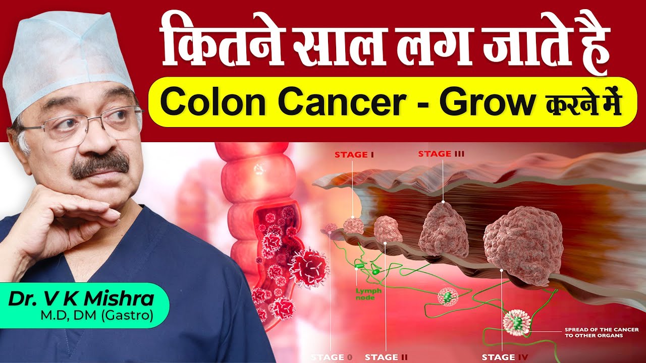 कितने साल लग जाते है colon cancer grow करने में || HOW LONG DOES IT TAKE COLON CANCER TO GROW