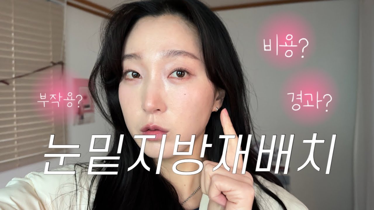 내돈내산) 고민하던 눈밑지방재배치하고 왔어요! 수술날부터 한달차까지의 과정 유후
