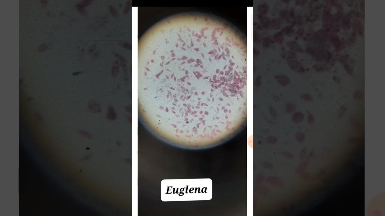 how euglena look actually. slide of euglena. protozoa. euglena