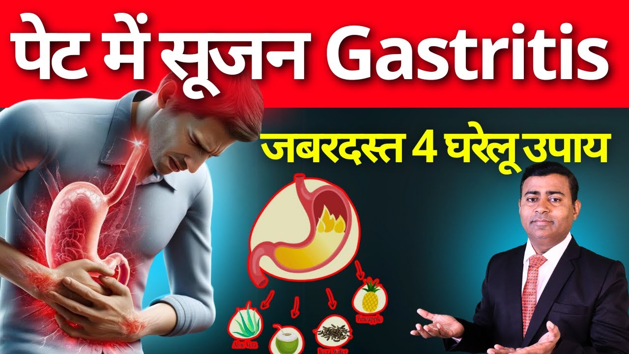 पेट में सूजन gastritis कारण लक्षण इलाज। सबसे अच्छे 4 घरेलू उपाय  gastritis in hindi #gastritis
