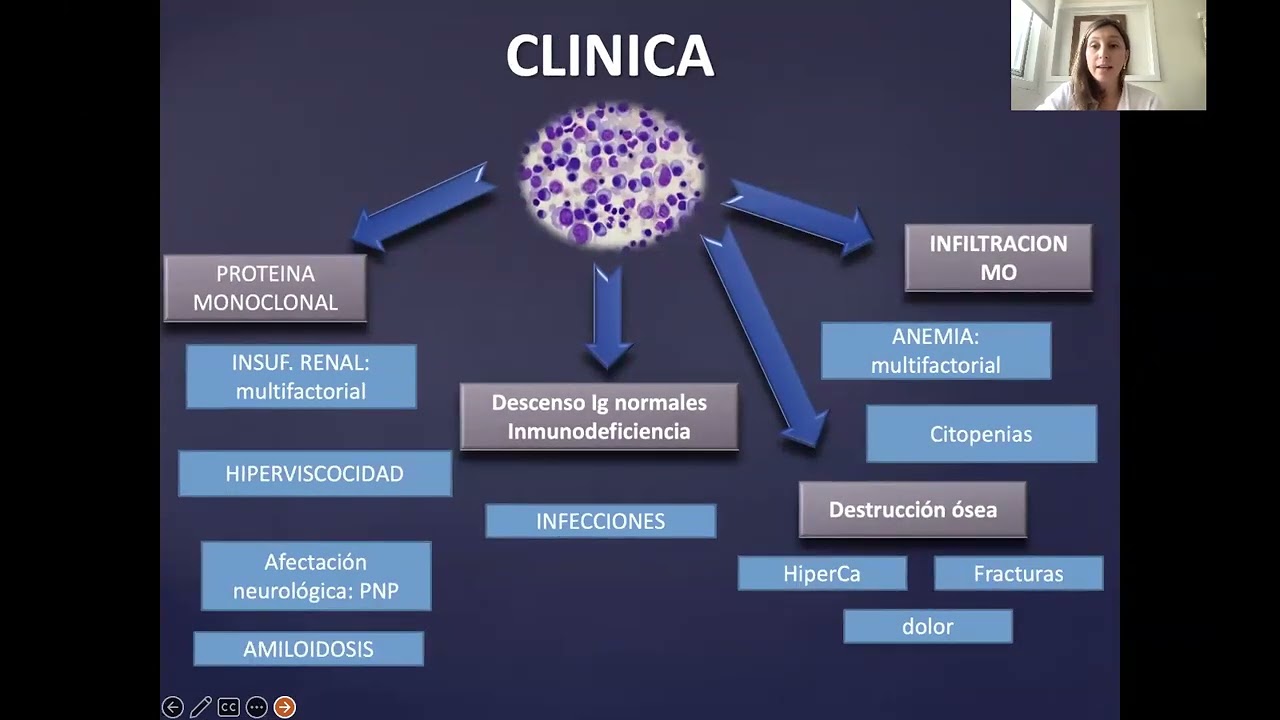 Gammapatías Monoclonales