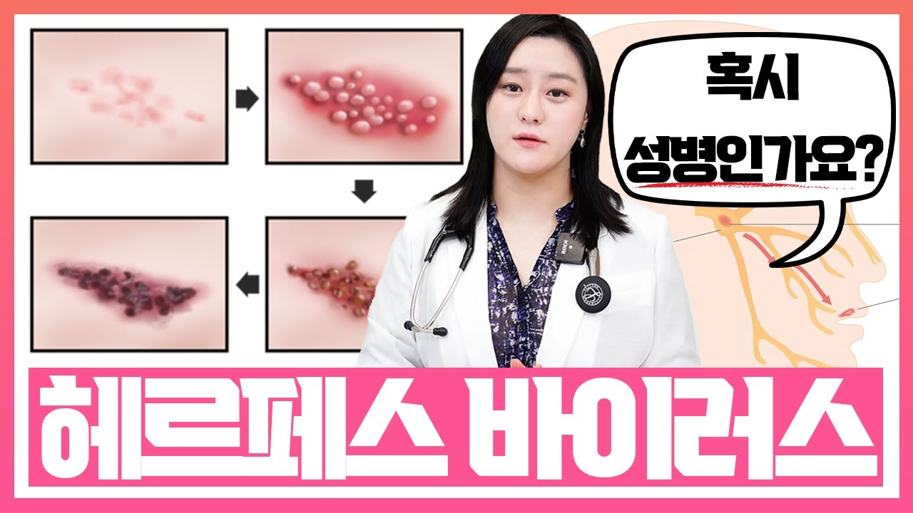 (ENG)신경 쓰이는 입술포진, 헤르페스 1형에 대해서 알아보자!