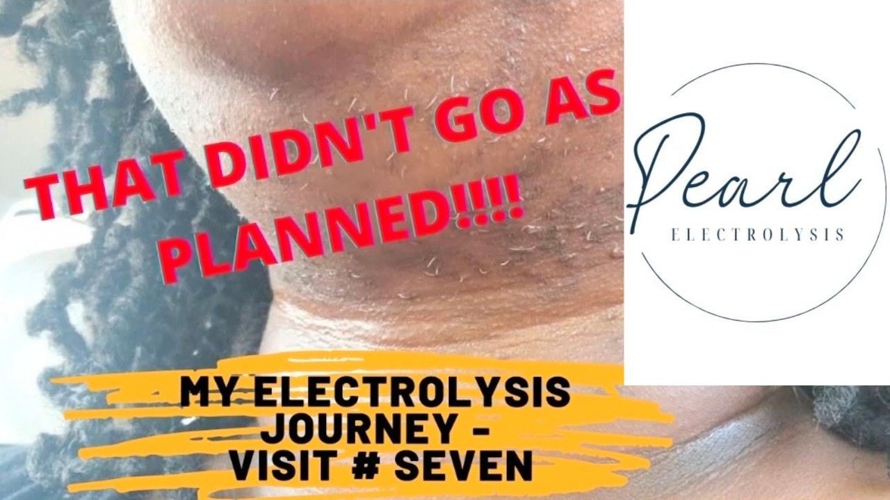 That did NOT go as planned! | My electrolysis hair removal Journey | Visit 7